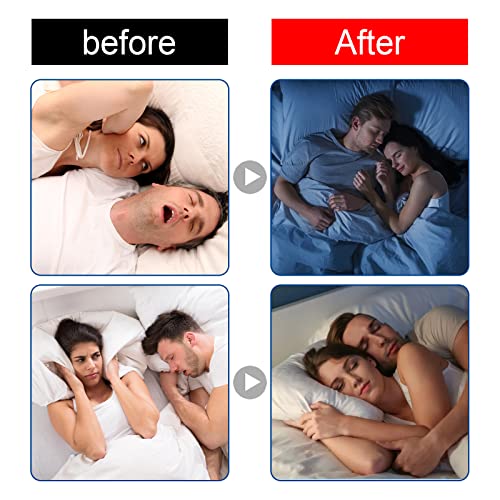 60 Count Anti-Snoring Hypoallergenic Mouth Sleep Tape