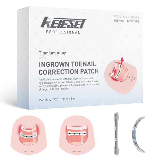 Titanium Alloy Ingrown Toenail Corrector Kit, Curved Nail Repair Patch with Memory Silicone, Toenail Treatment Tools, 0.59/0.67 in (15/17 mm)