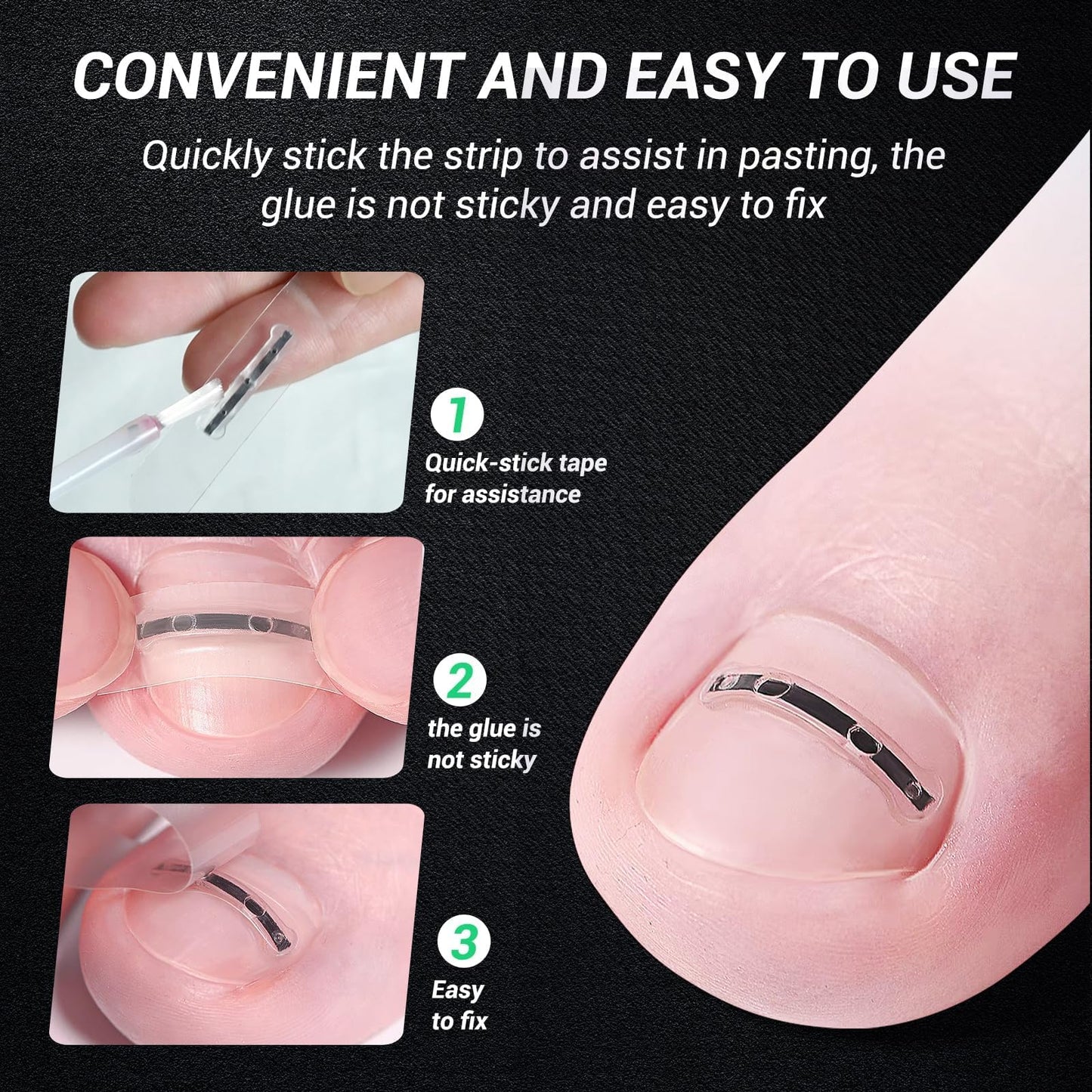 Titanium Alloy Ingrown Toenail Corrector Kit, Curved Nail Repair Patch with Memory Silicone, Toenail Treatment Tools, 0.59/0.67 in (15/17 mm)