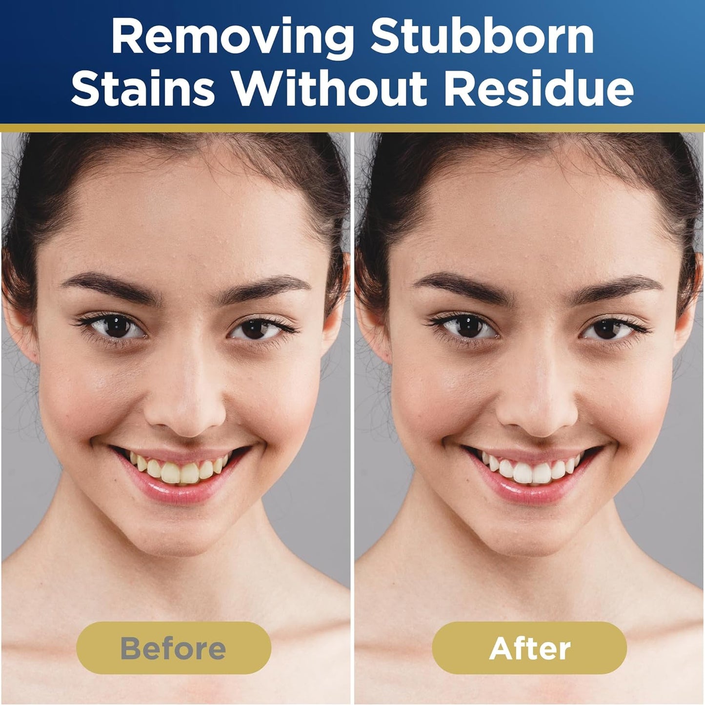 Achieve a Dazzling Smile with 60 Gentle Whitening Strips for Sensitive Teeth - Quick and Lasting Results in 7 Days