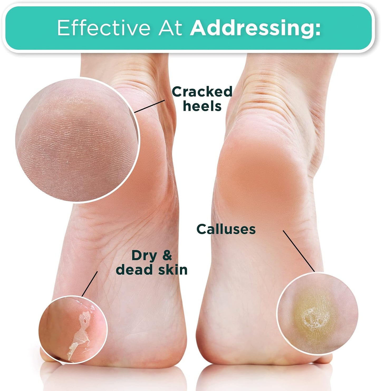 2 Pairs Coconut Foot Peel Mask - Smooth Soft Feet Natural Exfoliating Treatment