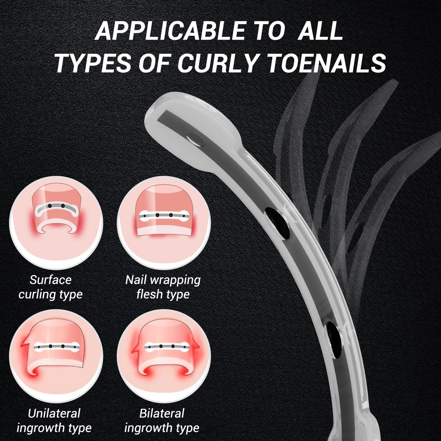 Titanium Alloy Ingrown Toenail Corrector Kit, Curved Nail Repair Patch with Memory Silicone, Toenail Treatment Tools, 0.59/0.67 in (15/17 mm)